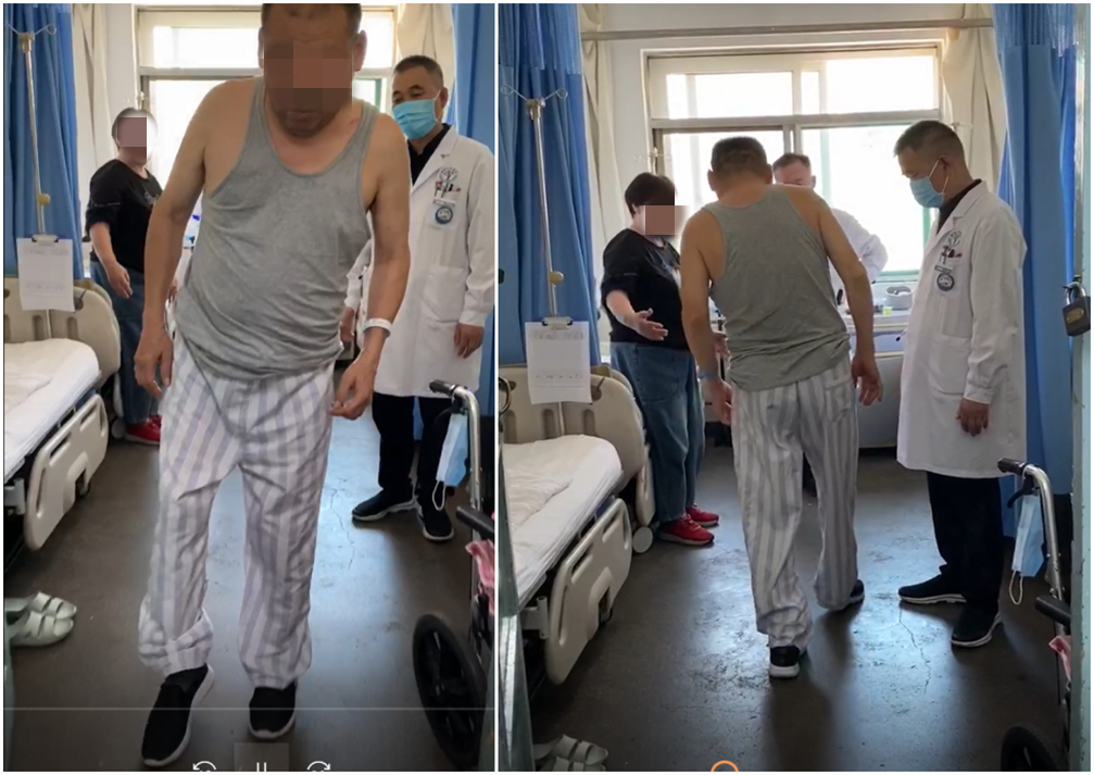 西安市红会医院风湿免疫内分泌科治疗一例免疫介导性周围神经病