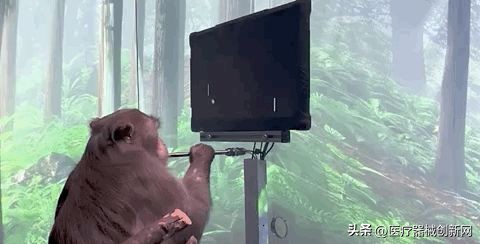 马斯克脑机接口临床试验是真的吗,fda马斯克脑机接口