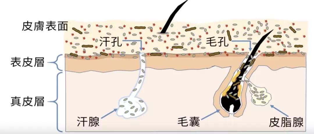 战痘全攻略4种痘痘的祛痘秘诀,痘痘交流必看祛痘方法