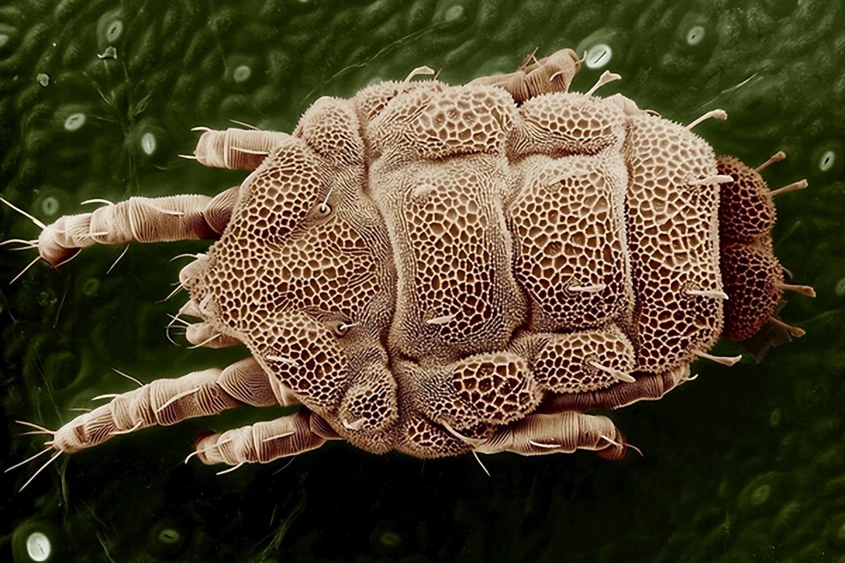 床上的螨虫和植物的螨虫一样吗,背带上有螨虫床上有螨虫怎么治