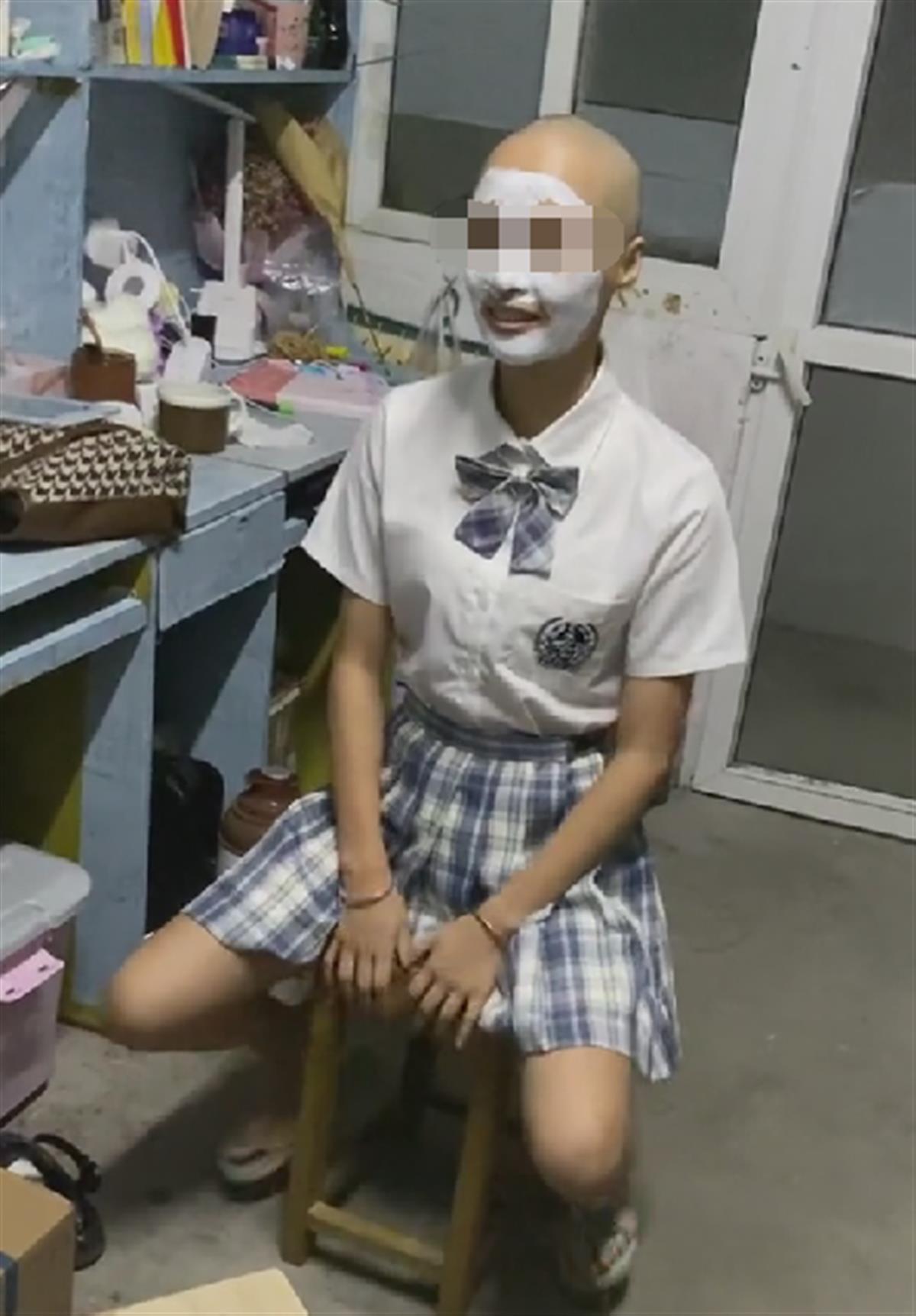 女人剃光头改变脱发发量,女学生频繁掉发索性剃成光头