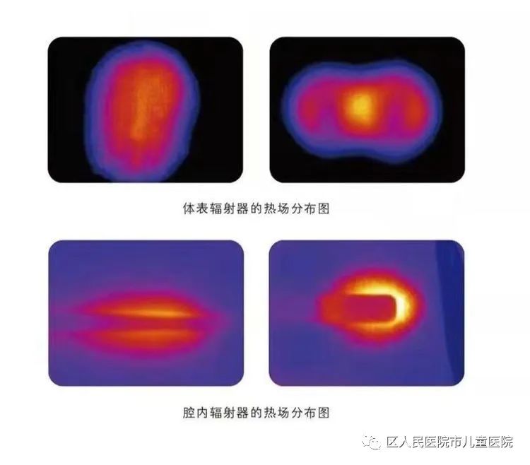 微波多功能治疗仪的功能,微波多功能治疗仪日本