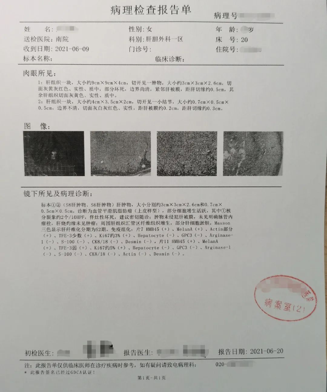 我的肚子中间有一条缝,我的肚子上为何有条竖线