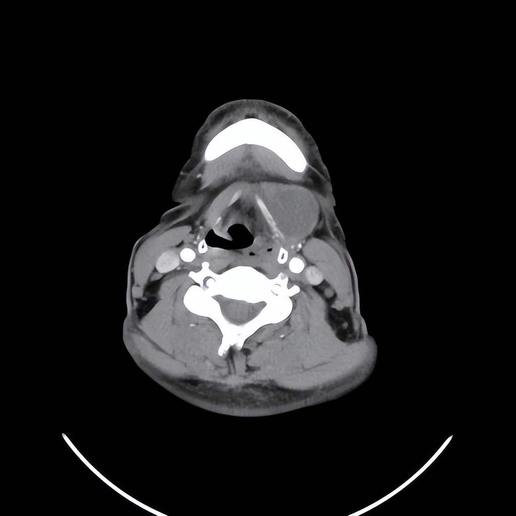 颈部有肿块不痛不痒严重吗,颈部肿物恶性的可能大吗