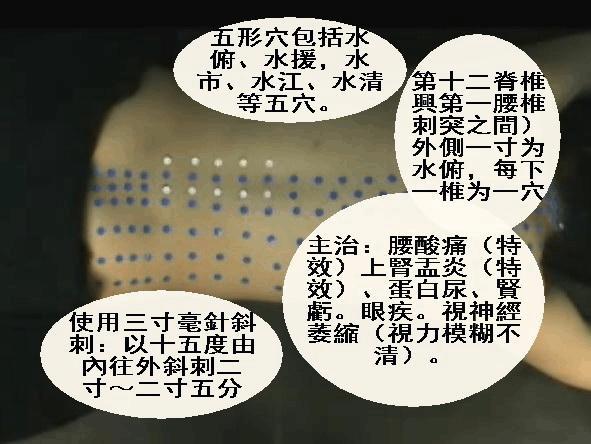 泌尿系疾病针灸,泌尿系统感染针灸哪里最有效