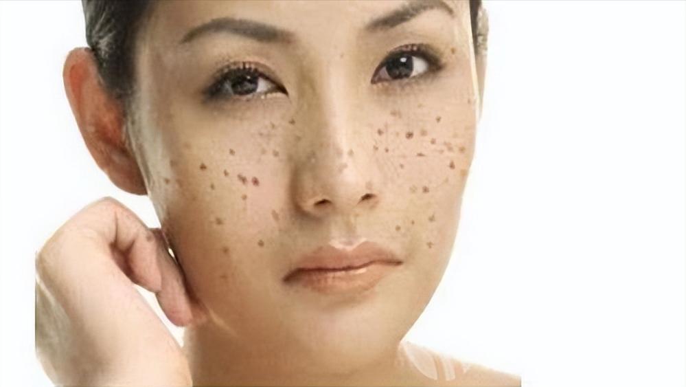 女性缺乏雌激素的七个表现,雌激素枯竭的症状