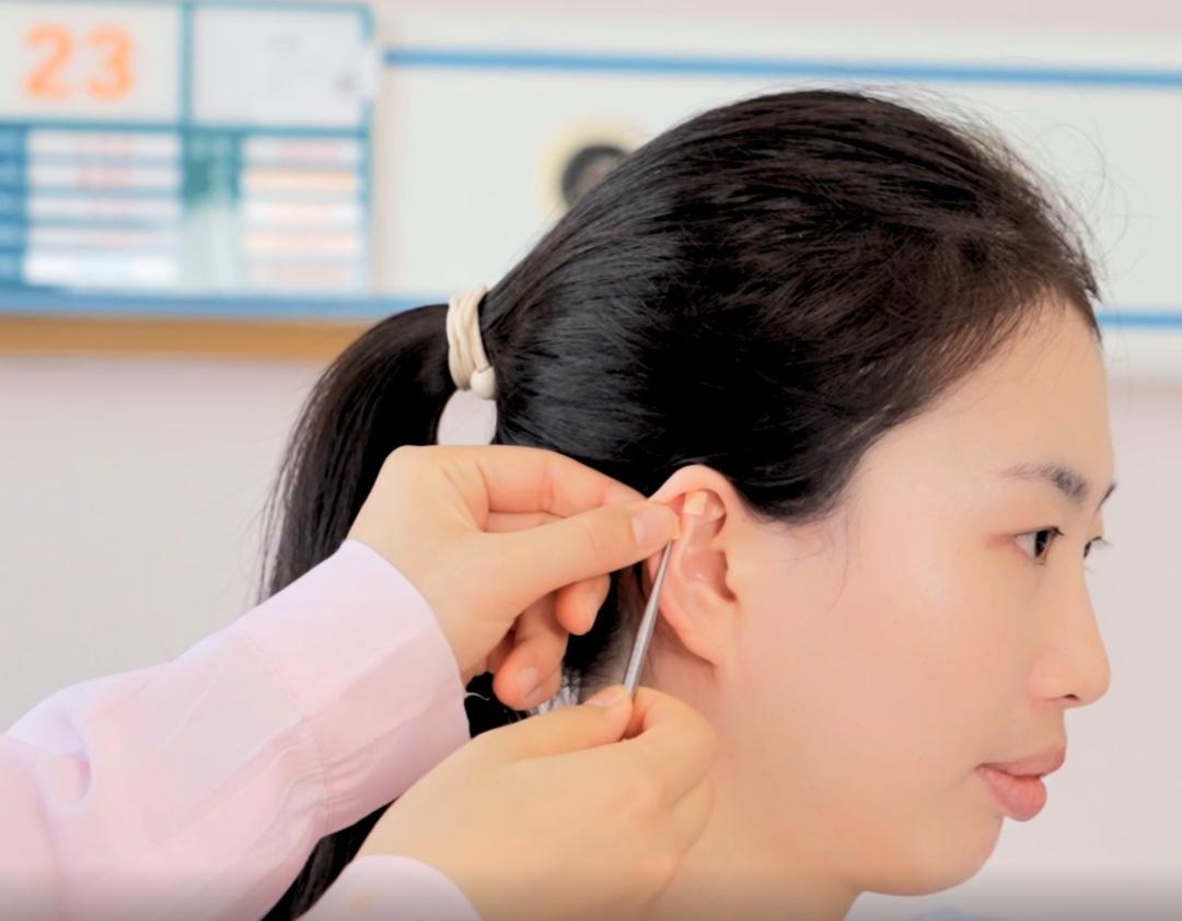 中医之光照亮健康——听苏弯弯讲述中医护理专科护士的日常