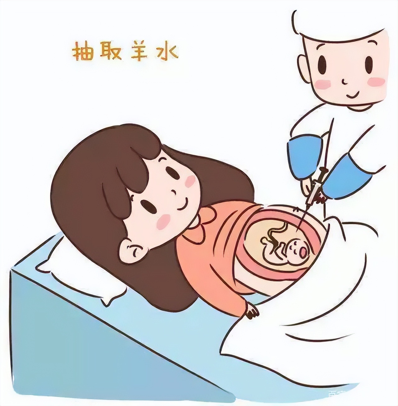 【六盘水市妇幼保健院健康科普】羊水穿刺小科普