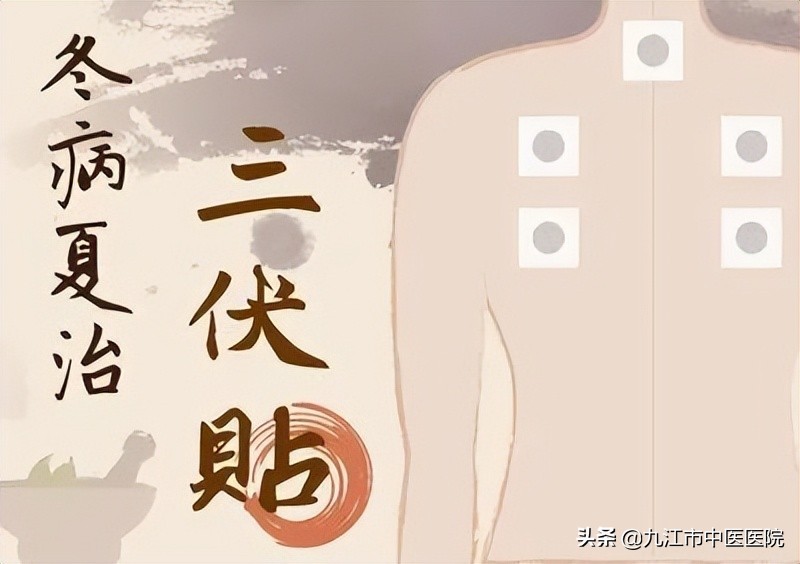 三伏贴治冬病,冬病夏治中医推荐三伏贴