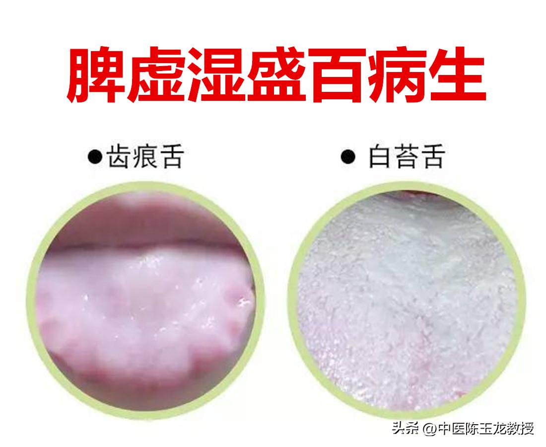 湿重困脾用什么中药,湿祛了脾胃也就好了吗