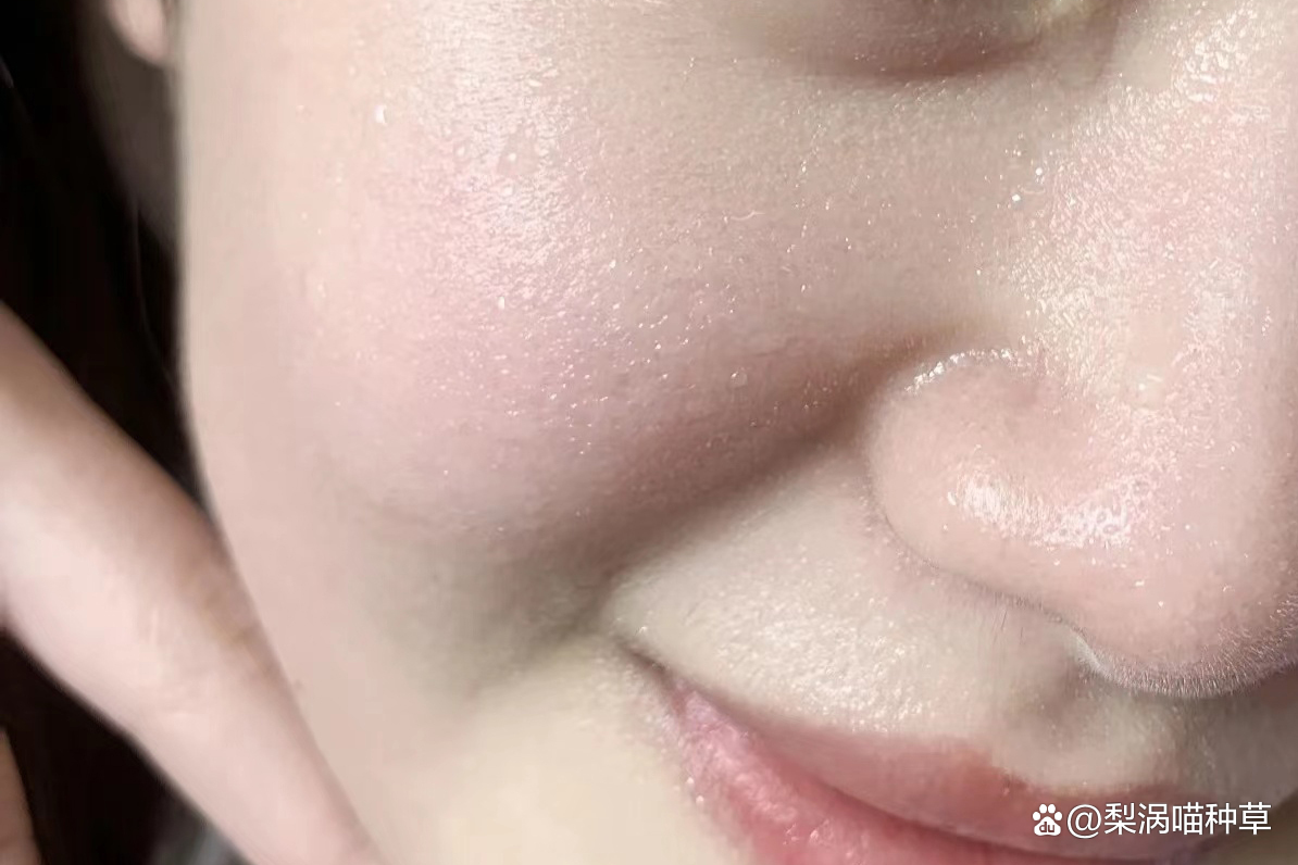 油皮护肤看起来油,油皮痘痘肌看过来