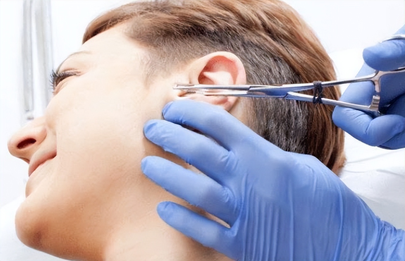 耳朵特别痒又掏不出耳屎怎么办,耳朵里痒一掏就流水是什么原因