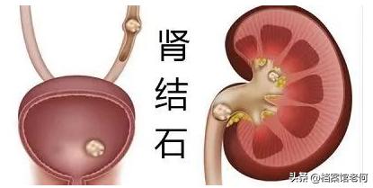 得道高僧为什么火化后会有舍利子,为何高僧火葬后会有舍利子