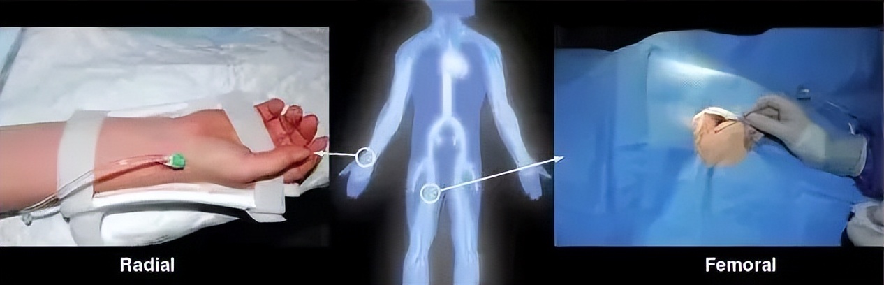 济南莱芜人民医院新院区,济南市人民医院祛鼻部疤痕