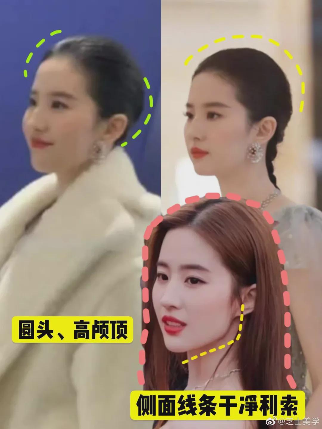 明星如何解决脱发问题,明星也扛不住脱发