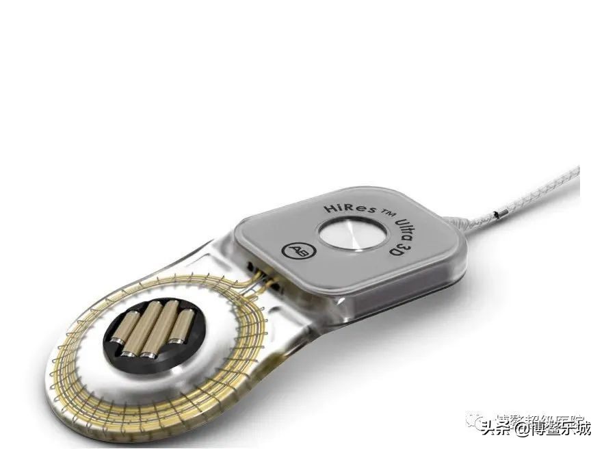 海南乐城人工耳蜗 (乐城耳蜗)