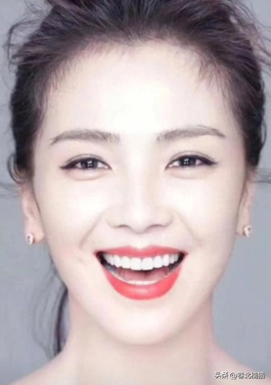 明星嘴突戴牙套前后对比,明星和假牙