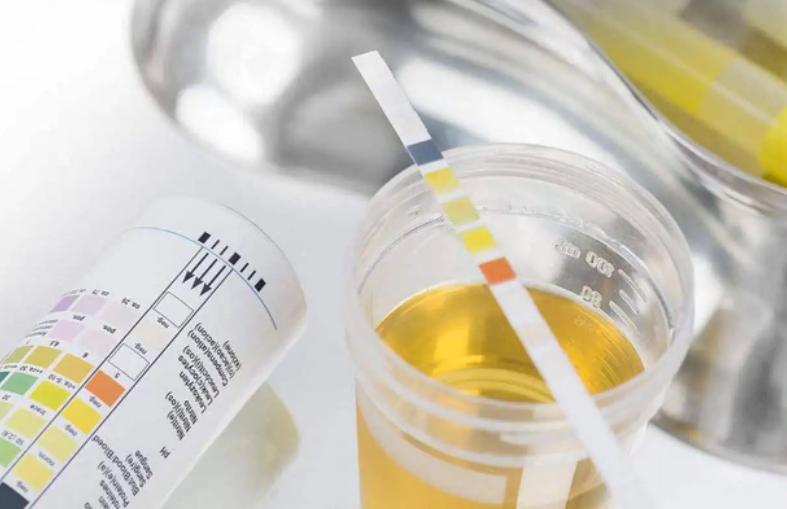 痛风已经忌口了为什么还一直发作,痛风为啥要忌口豆制品