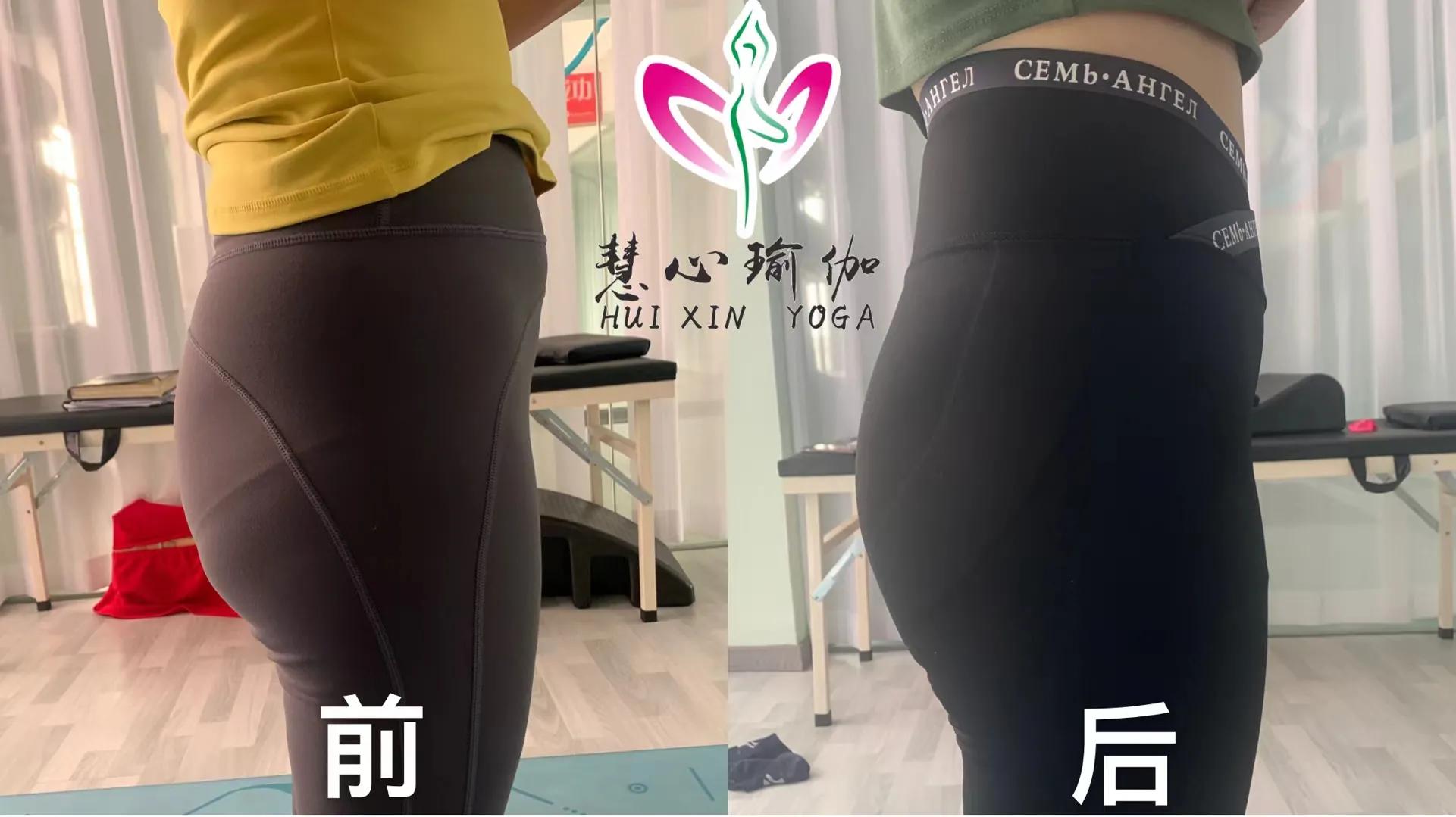 产后修复哪些有必要哪些是智商税,医院盆底肌修复是智商税吗