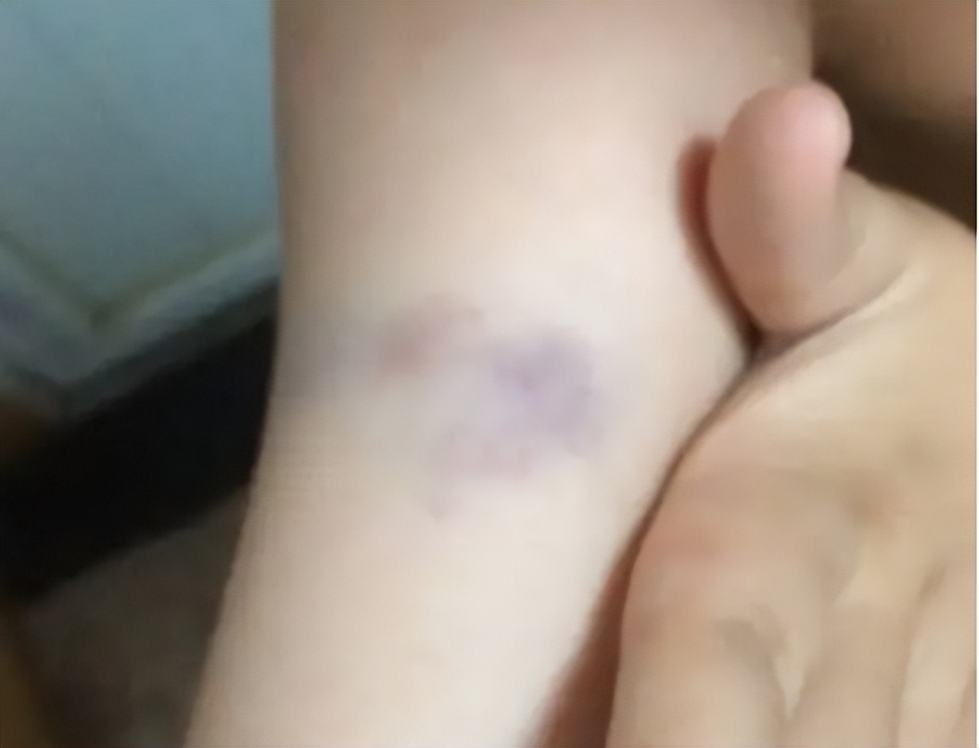 筋膜枪真的能长期使用吗,筋膜枪有没有必要用