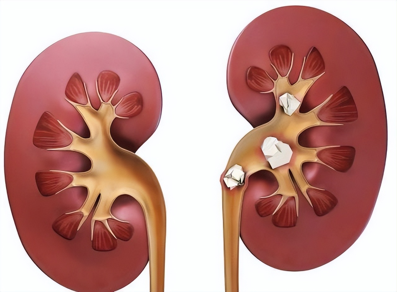 晚上喝牛奶和早上喝牛奶哪个更好,长期夜间喝牛奶会不会有什么危害