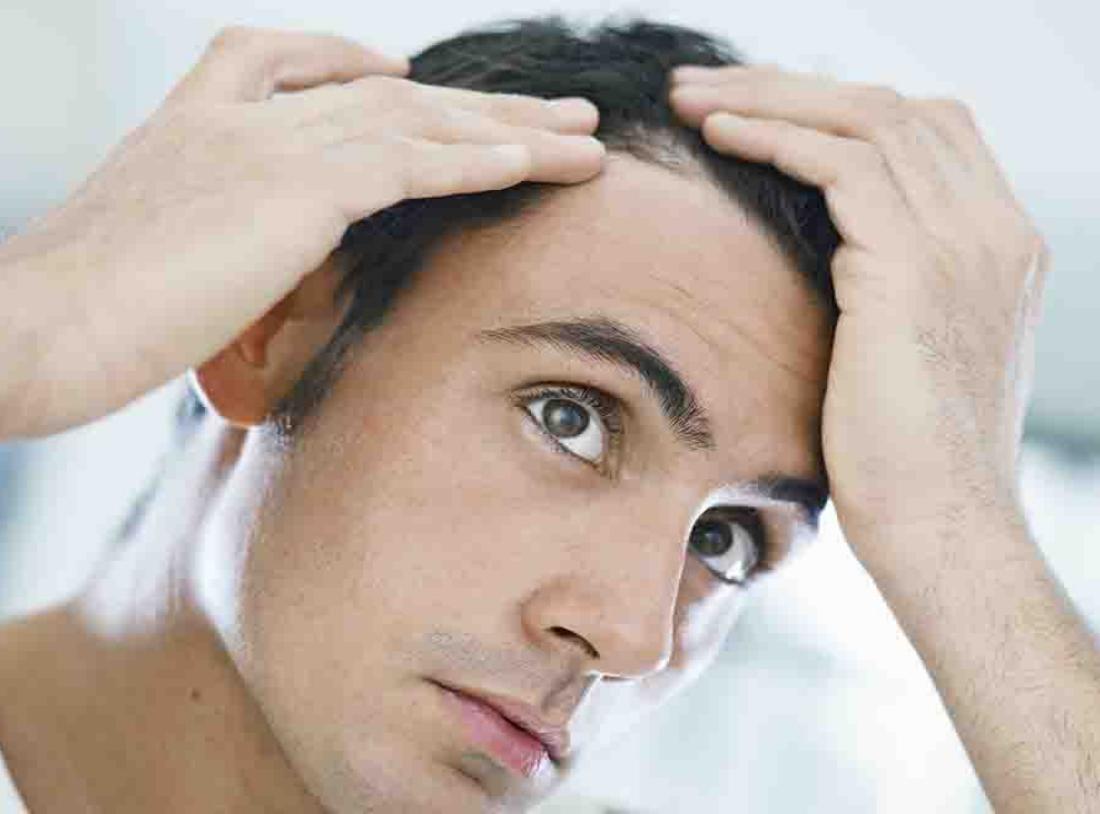怎么脱发最有效果,怎么样脱发才算严重
