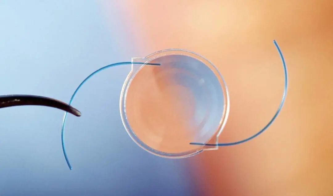 白内障久拖不治成弱视,白内障一直不做手术有什么后果