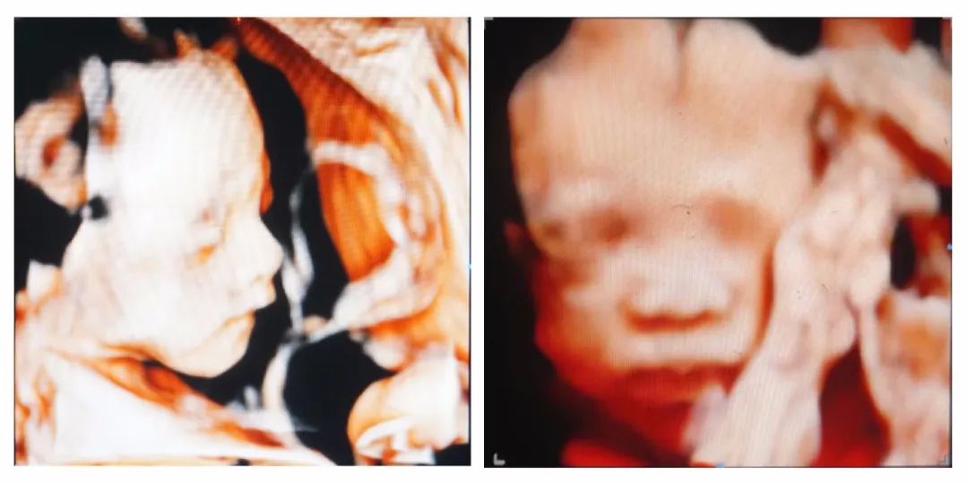 宝宝有智力问题的话会有哪些表现,宝宝智力发育有问题症状