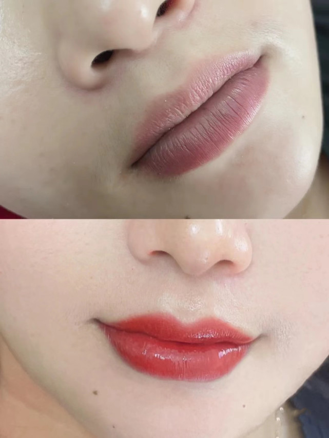 纹唇后不想要了纹唇失败怎么办,纹唇的注意事项具体有什么