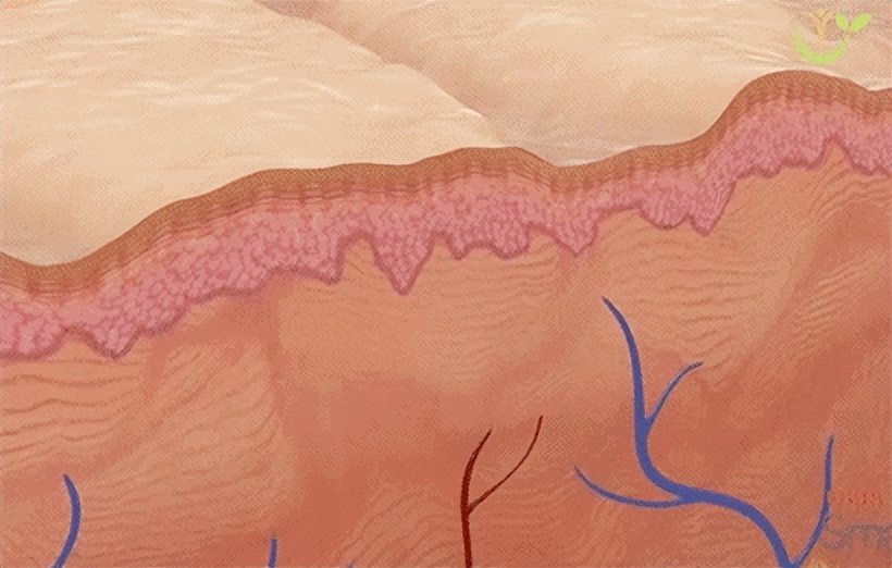 缩小毛孔7个实用方法小技巧,缩小毛孔的最好方法