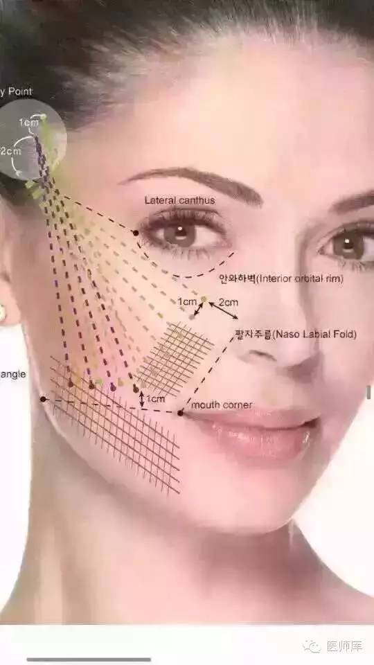 法令纹非常严重怎么消除,法令纹严重怎么处理比较好