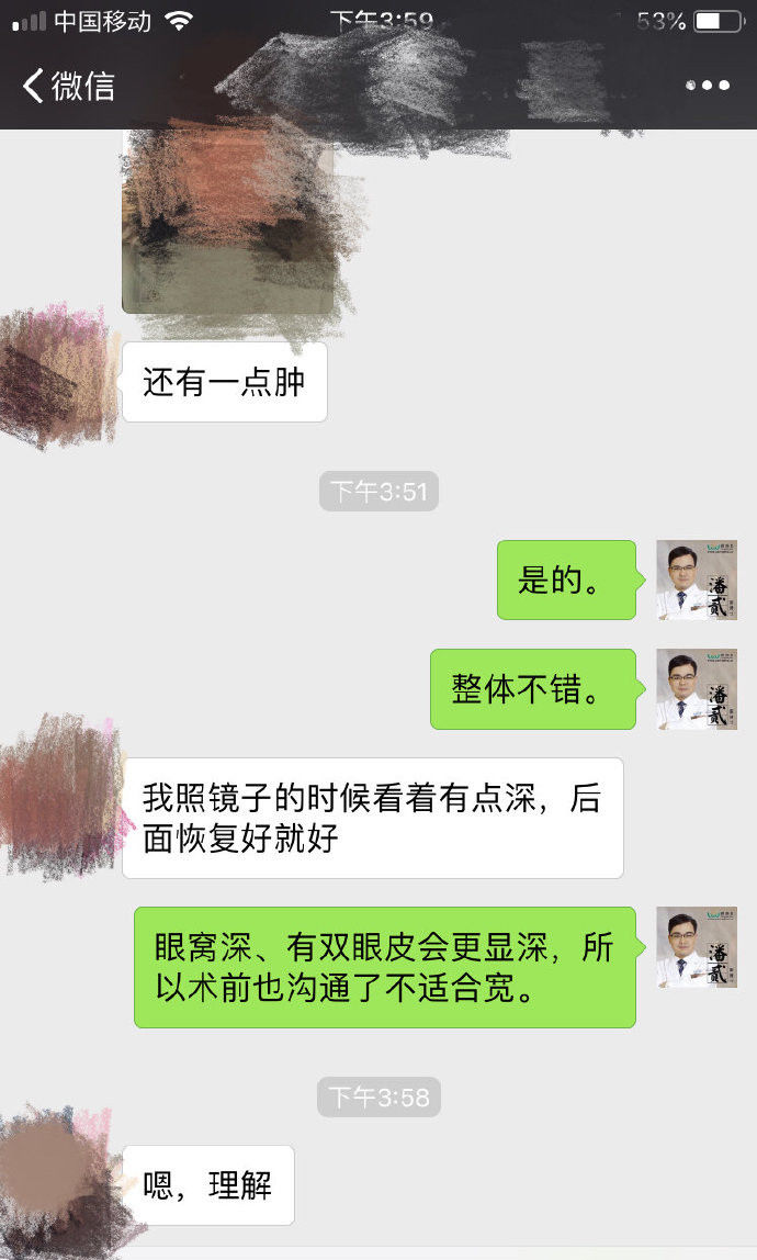 为什么不建议打眉弓,眉骨太低能做多宽的双眼皮