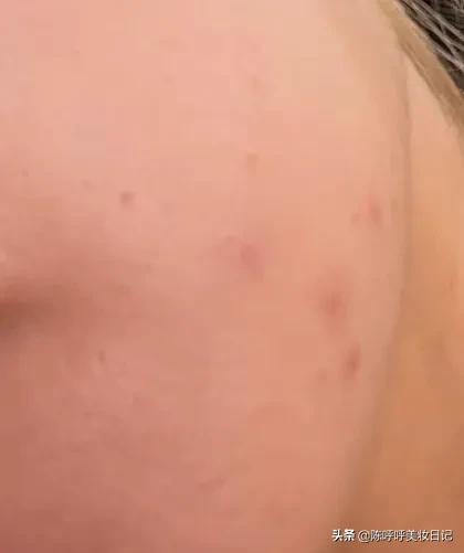 40岁阿姨的4个变美小技巧,如何让皮肤变得又白又嫩学生党