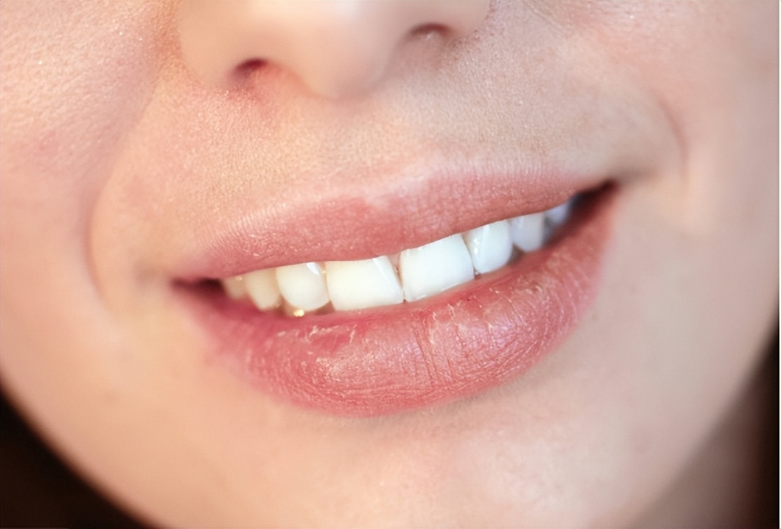 口干口苦有哪些疾病引起的,口干口苦要警惕四种疾病