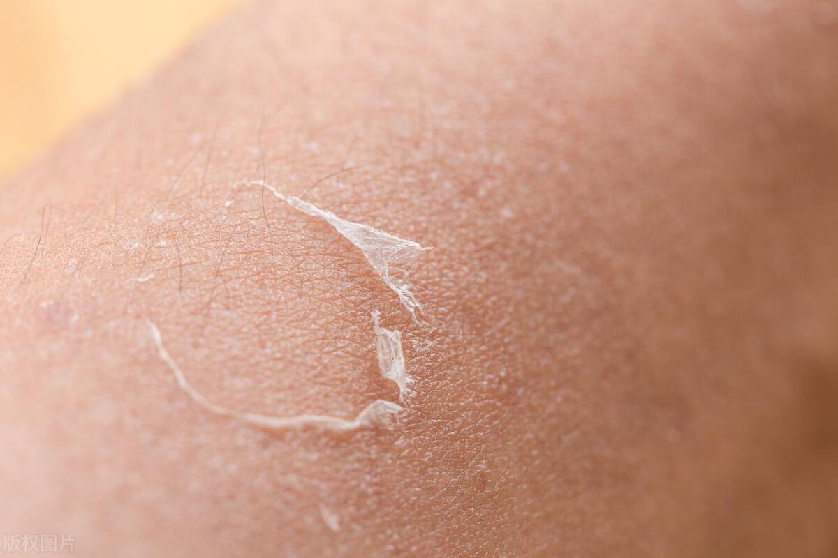 月经间隔半月又来是不是要绝经,月经停止多久叫绝经