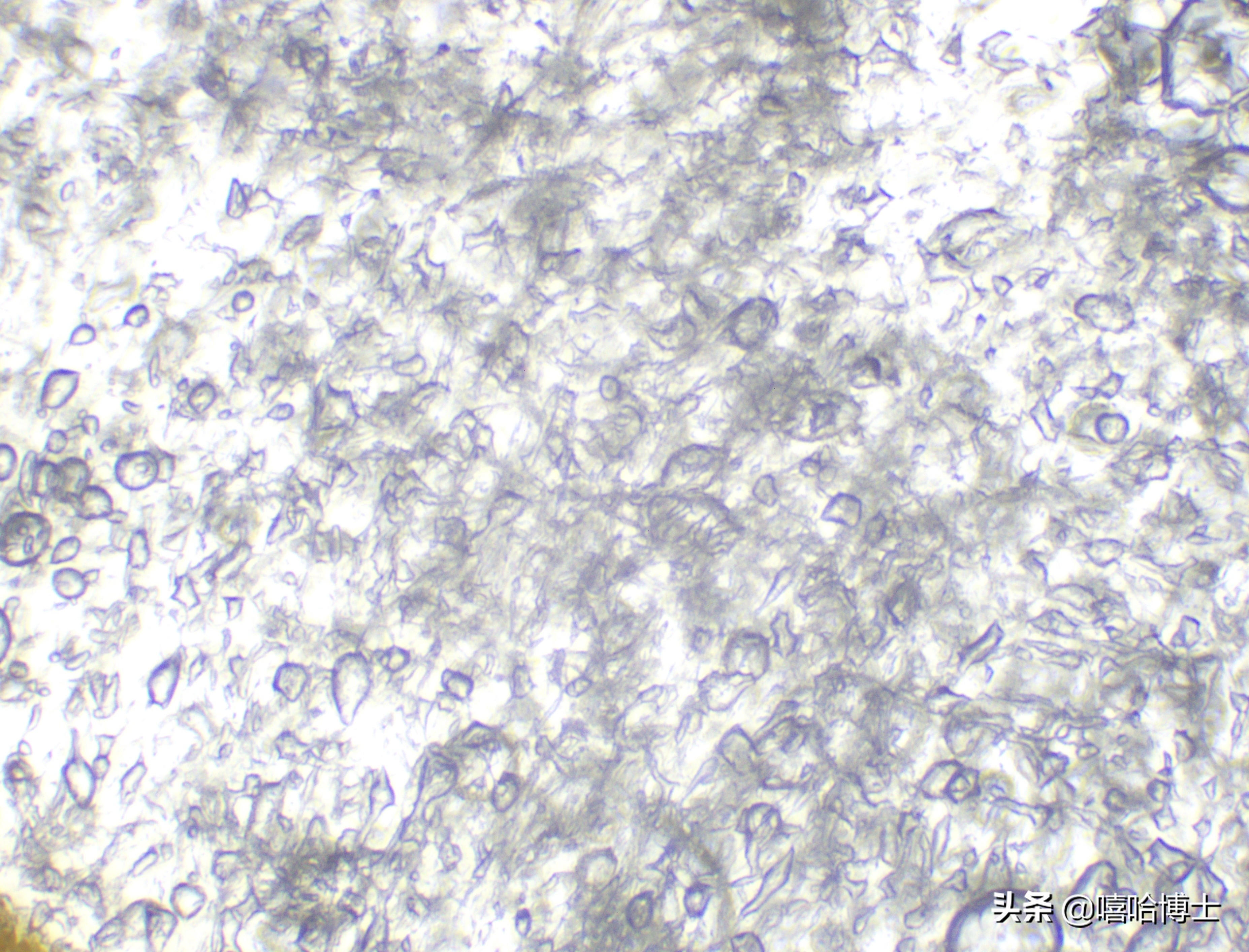 超级显微镜下的山竹,显微镜下的山竹果