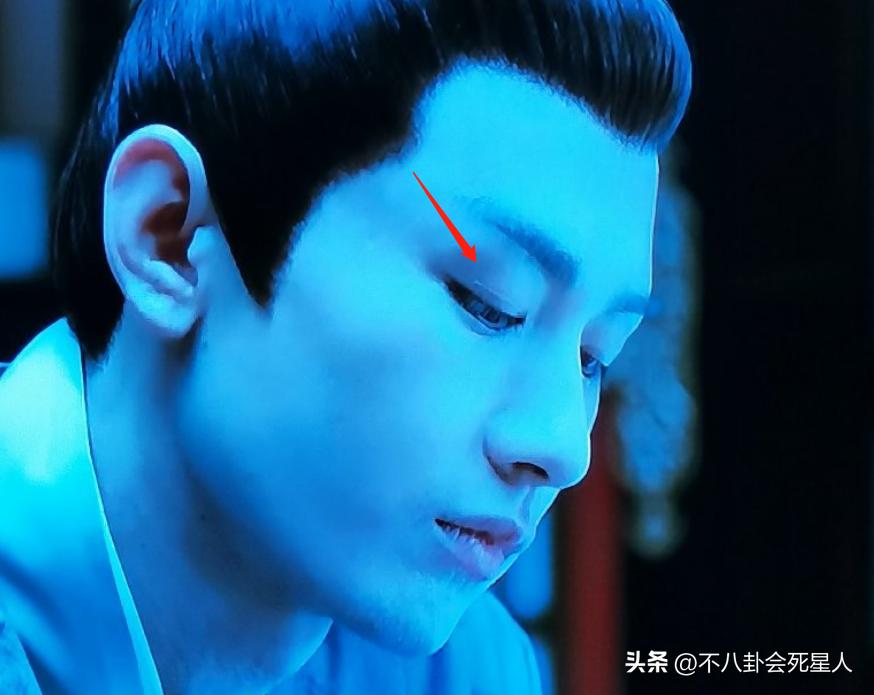 假双眼皮的明星,明星的假脸