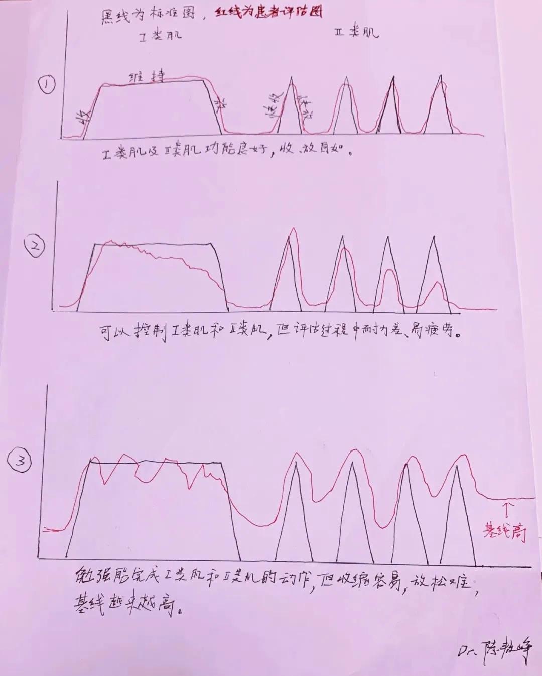 产后漏尿、肚子大因为盆底肌？凯格尔没用？正确锻炼方法需掌握