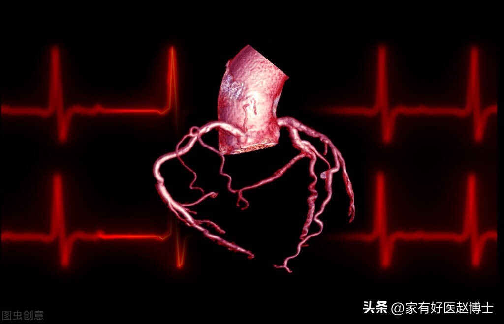 体检提示心血管局部钙化,体检发现冠脉见钙化影是什么意思