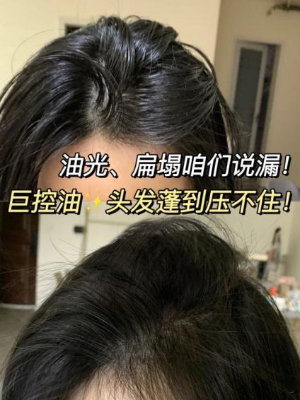 年轻人用哪款蜂花洗发水,蜂花洗发水国货第一名