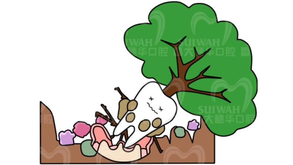 为什么蛀牙要补,为什么蛀牙不建议补门牙