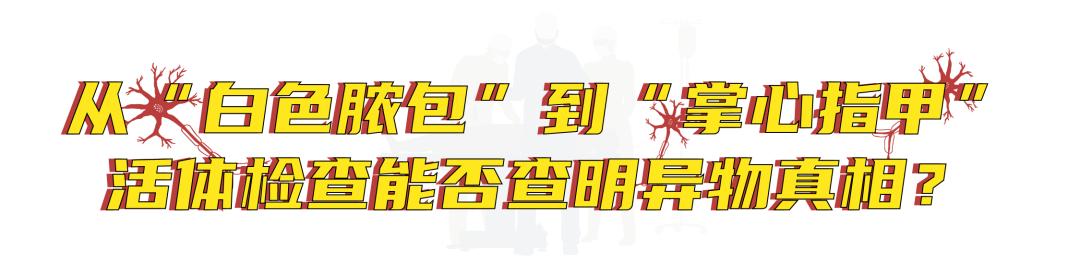 他得了什么病,他得的什么病