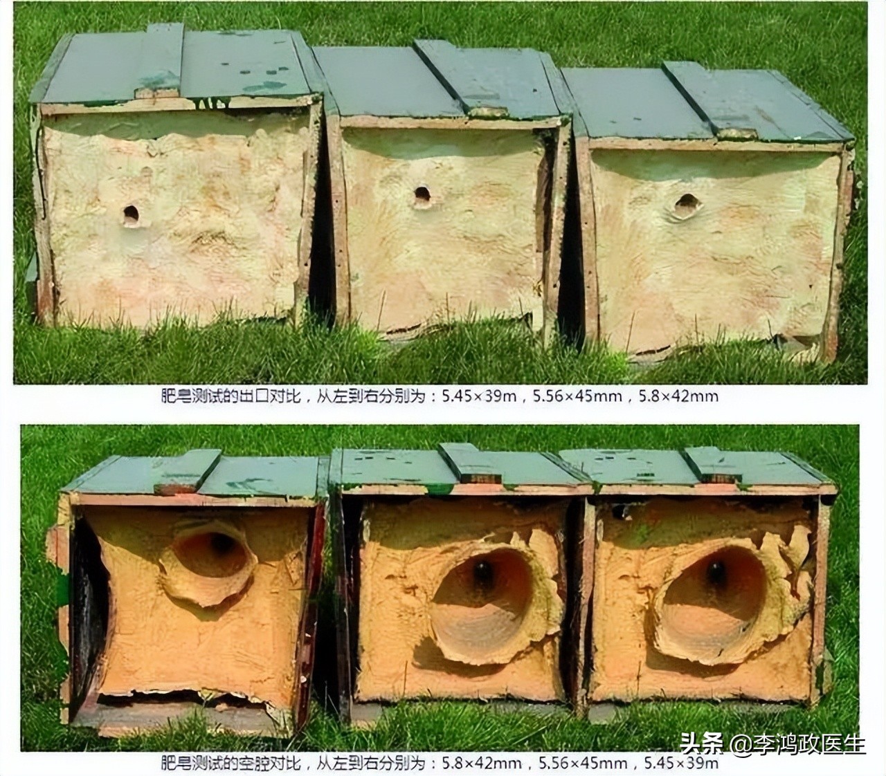 被子弹打中后怎么处理伤口,被子弹打中自己怎么处理