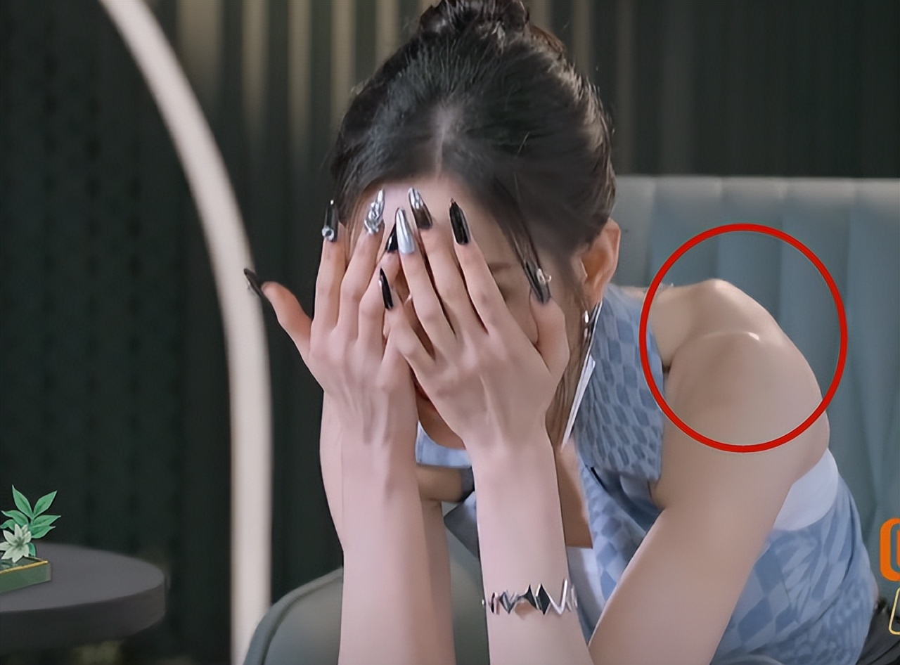 张天爱素颜录视频，头发稀疏头皮隐现！吴谨言同样也深陷脱发危机