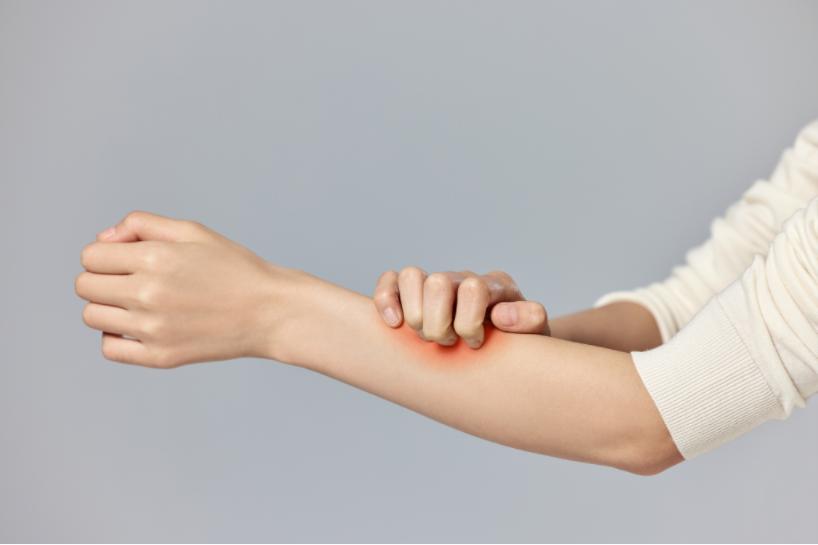 湿疹反复，不是因为“湿”，而是因为太“干”了？到底怎么解决