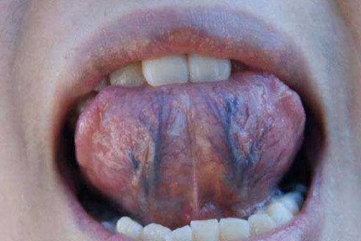 软化血管活血化瘀的中成药有哪些,心脑血管活血化瘀通络的中成药