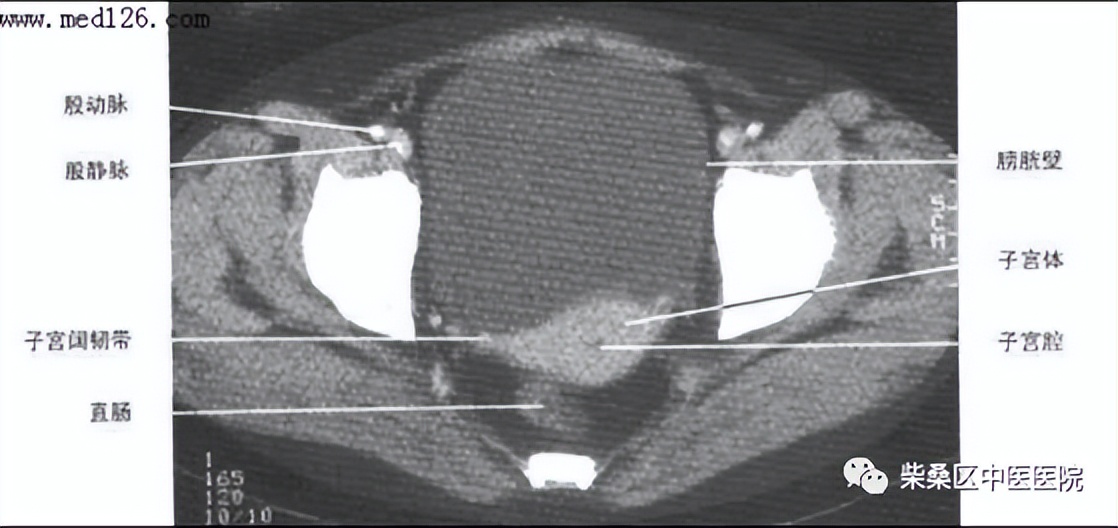 做ct喝水憋尿要多久,喝水憋尿做的尿常规准确吗
