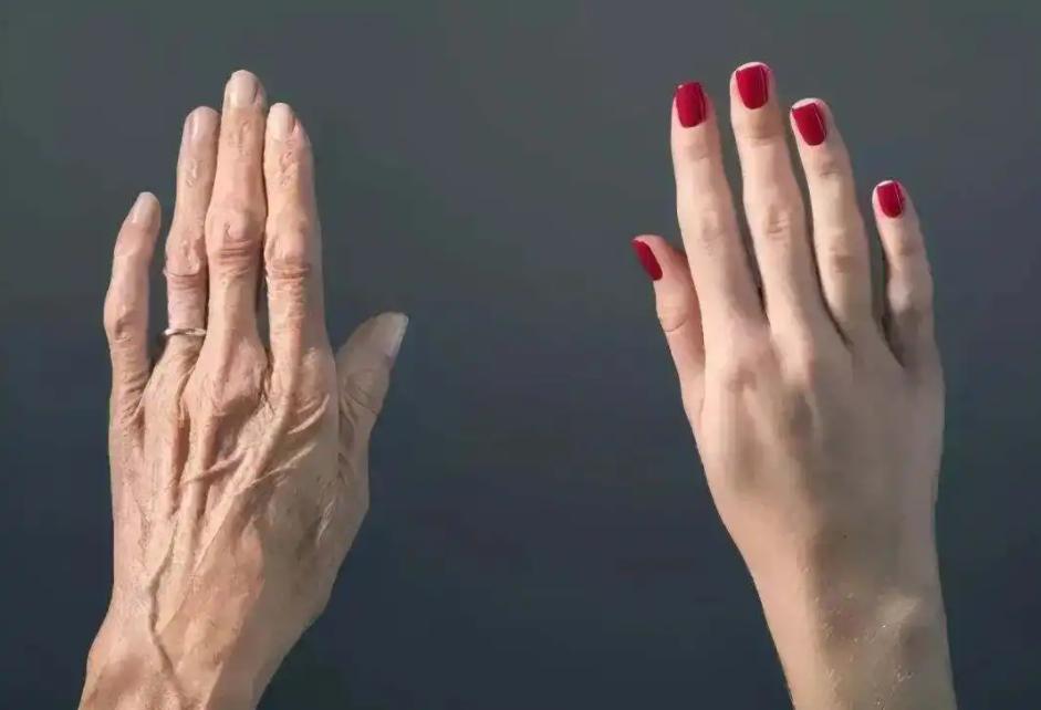 手臂爆青筋是天生的吗,为什么有的人手臂的青筋特别明显