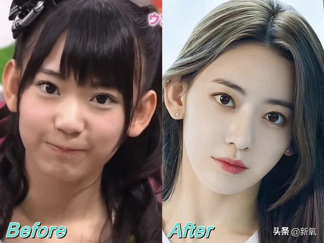 改一点赢很大？她整完鼻子直接美成断代神颜…