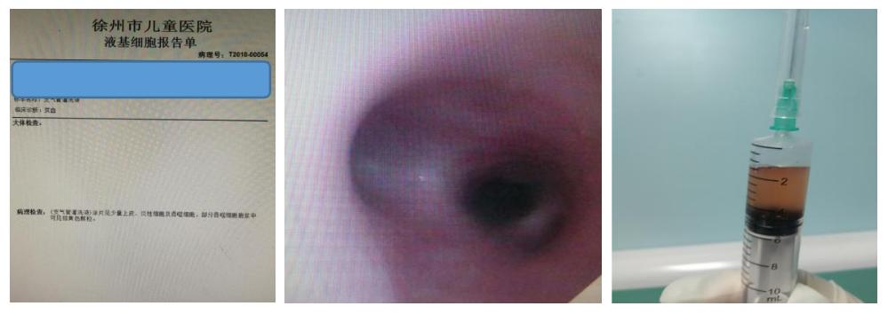 徐州市儿童医院呼吸二科,儿童呼吸介入科的设备